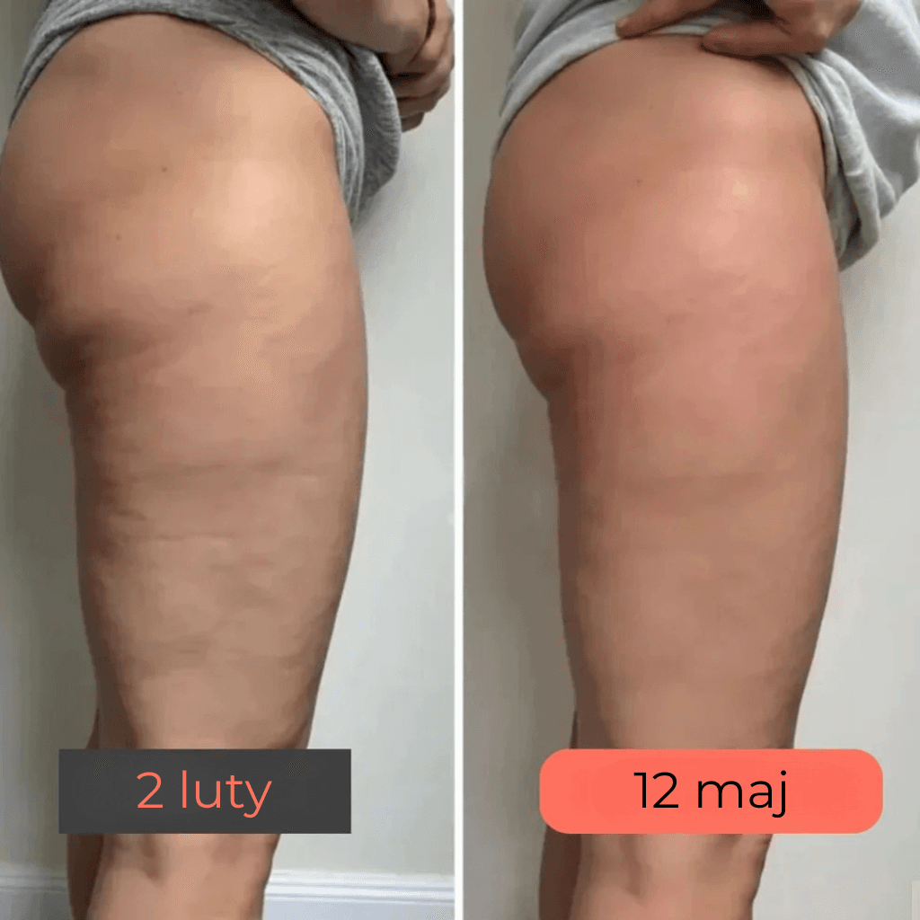 Virella - Legginsy modelujące 3D, które realnie wygładzają wygląd skóry