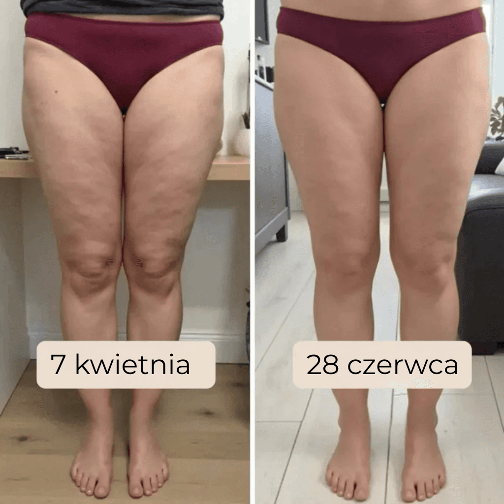 Virella - Legginsy modelujące 3D, które realnie wygładzają wygląd skóry